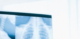 prześwietlenie kręgosłupa